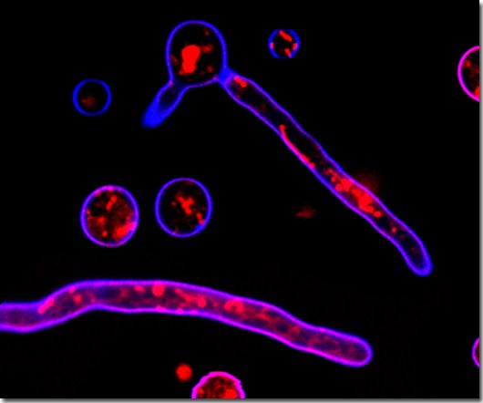 Is the Cause of Cancer a Common Fungus? [
