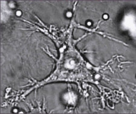 dendritic cell jpg